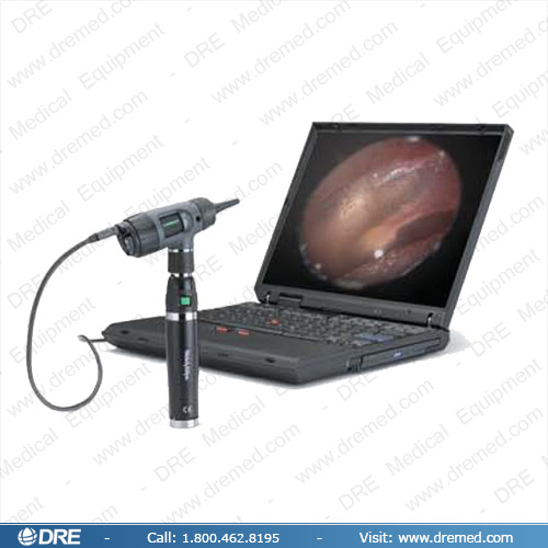 Welch Allyn Digital MacroView Otoscope